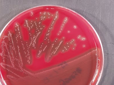 Blood agar base